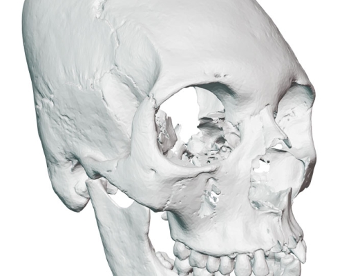 3D model of the skull from Atzgersdorf