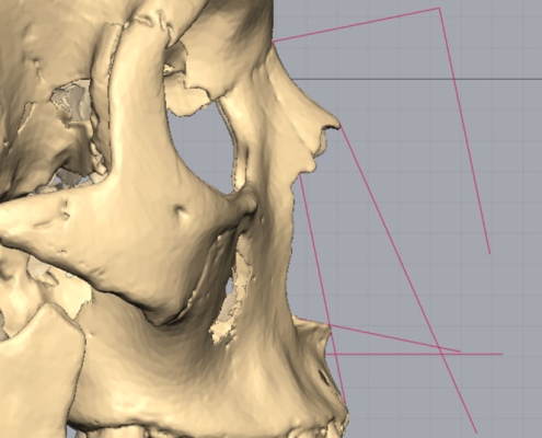 Image of nose profile shape estimation