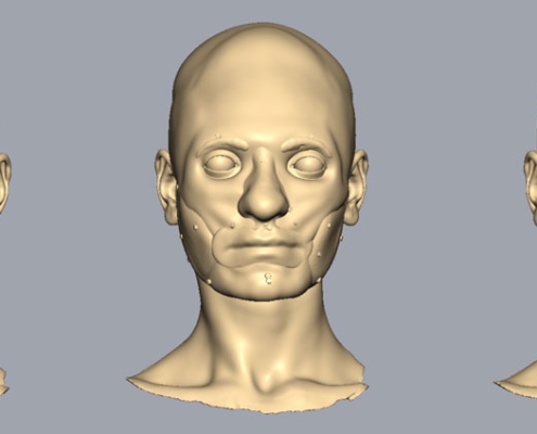 Image of the offset the different soft tissue layers merged together