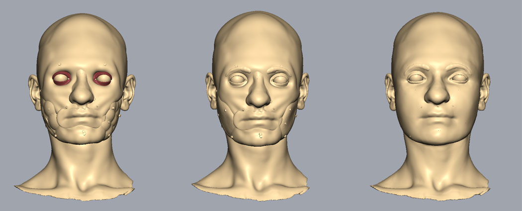 Image of the offset the different soft tissue layers merged together