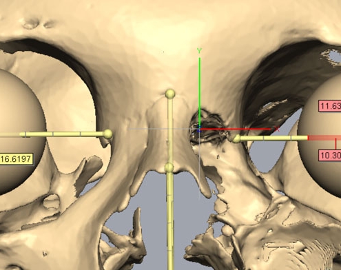 Image of eye estimation