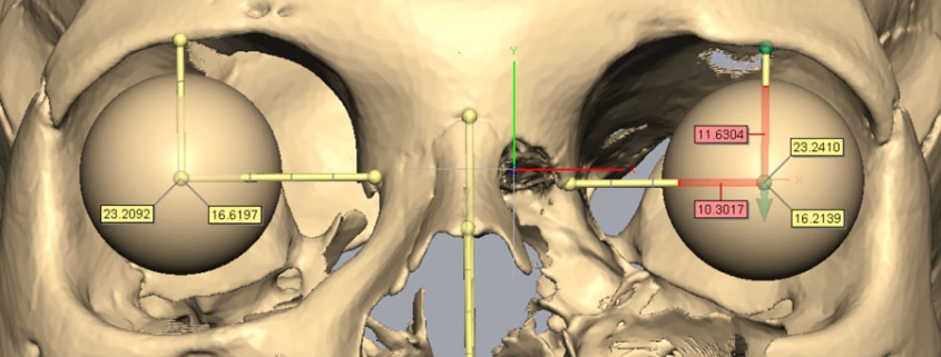 Image of eye estimation