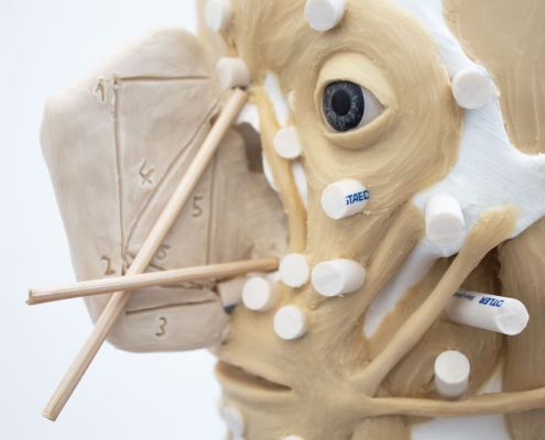 Picture of the estimation of the nose shape in profile