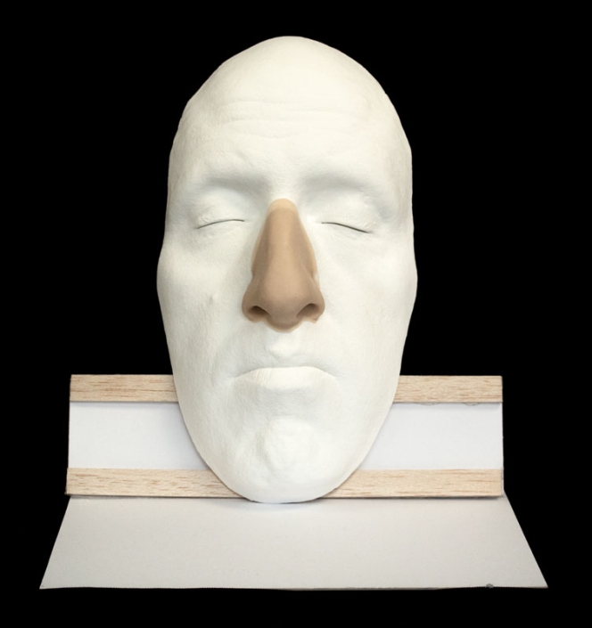 Nose prosthetic in silicone